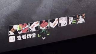 你問(wèn) 我也總說(shuō) 沒(méi)事