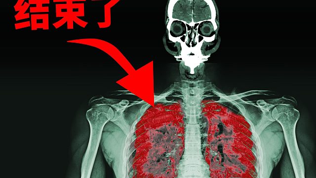 一位小伙子在焊接时不慎合成了“化学武器”，这是他的身体发生的变化