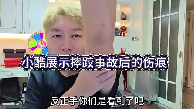 小酷展示摔跤后的伤痕，卧槽