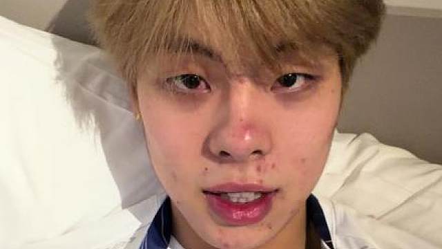 大年初一，铜牌到手了！