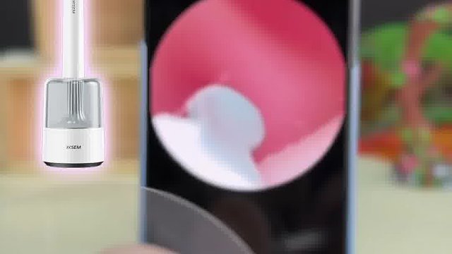 可视挖耳勺哪个牌子好？小孩挖耳勺推荐不踩坑，两大品牌对比