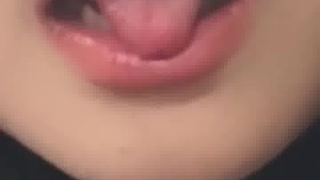 和别人亲嘴咬掉了  ​