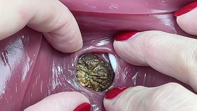 今天挖出了奇怪的东西