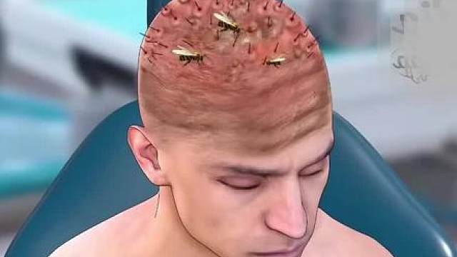 重口味密集恐惧症请划走！！！