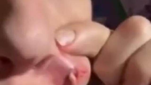 火疖子太可怕了