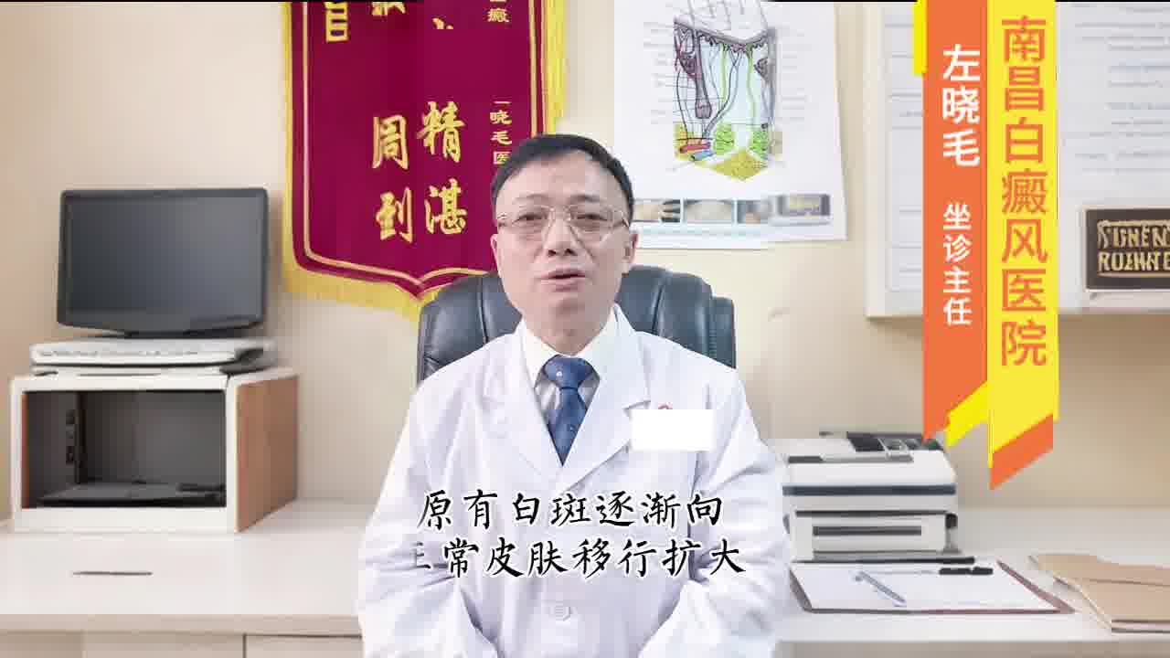 南昌白白-怎么区分白白2