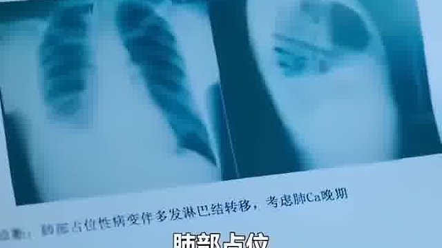 大爷一句话直接送走隔壁床大爷