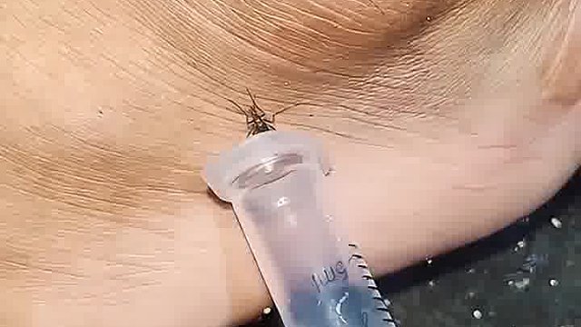 高手抓蚊子，傻蚊子也不知道跑