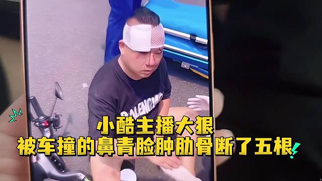 小酷主播大狠被车撞的鼻青脸肿肋骨断了五根