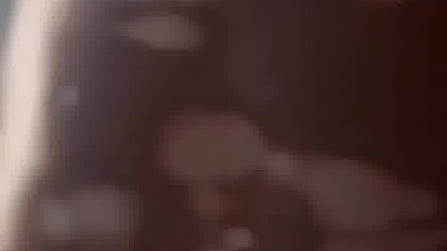 黑人为融入白人社会，想尽办法得白癜风
