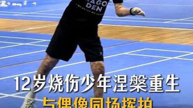 从ICU到羽毛球场，12岁烧伤少年涅槃重生，与偶像同场挥拍