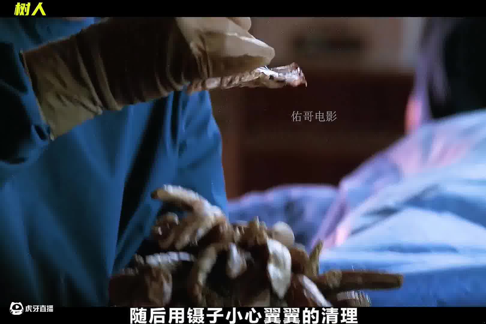 男人身上竟长满了可怕的树枝