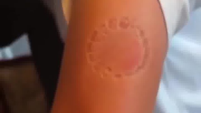 唾液中可是有很多东西的……咬出血可以容易出问题的  -