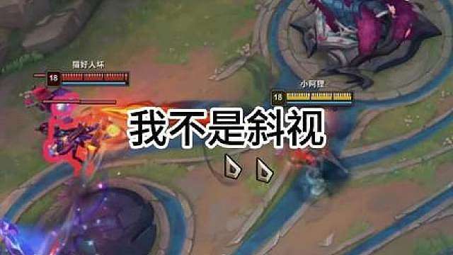 以前他们说我斜视我不信