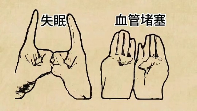 这样的小动作你会了吗