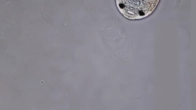 在显微镜下，两只吸虫蠕虫，在"散步"时候相遇了。