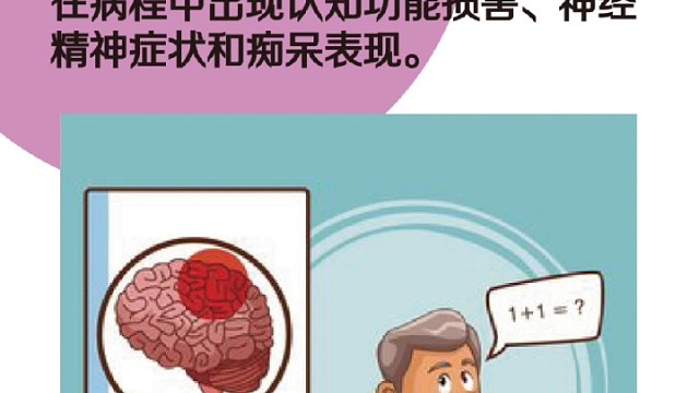 帕金森不止有抖