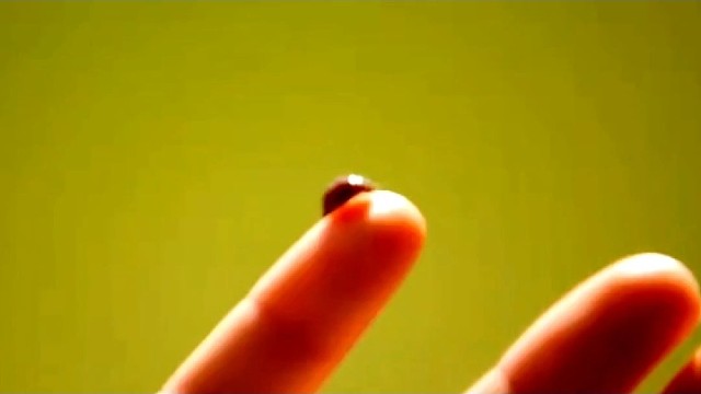 一分钟分辨帕金森还是帕金森综合征