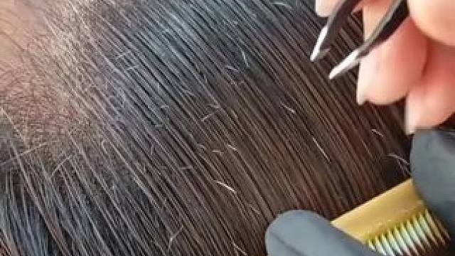 不锈钢眉夹，夹得紧不断毛