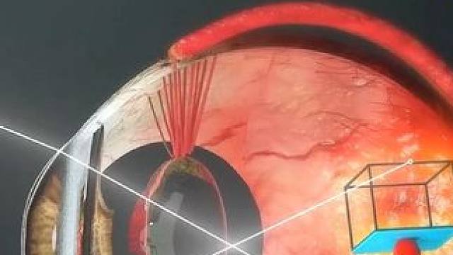 刷到这个视频，你眼睛是不是不自觉的离手机远了点#原理动画 #知识科普 #3d动画