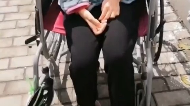 运动神经元病即渐冻症，为较危重的疾病，生存年限相对较短。而且患运动神经病后，患者的免疫力较差，易出现