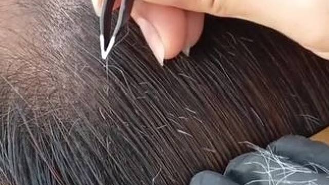 夹白毛，夹胡子，夹眉毛都行