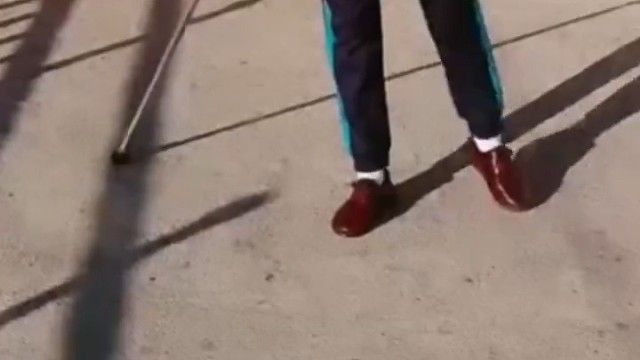 目前，医学界对于运动神经元病的治疗还没有找到确定性的疗法，尤其是对于其致病机制尚不明确的ALS(渐冻