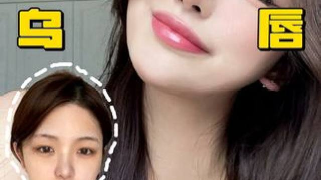 光子嫩肤还能打嘴巴？？本深唇星人有救了！！ #深唇 #光子嫩肤 #医美 #纹唇