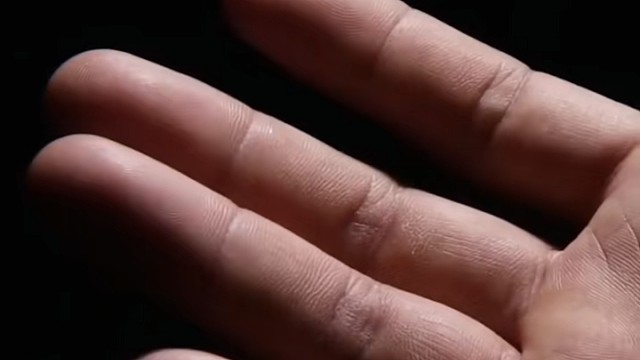 一起来看微观下的手是如何出汗的