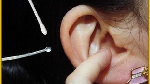 女人的耳朵里爬进一条浑身带毛的大家伙。【纯属纪录片 请通过 】#奇葩 #掏耳朵 #采耳