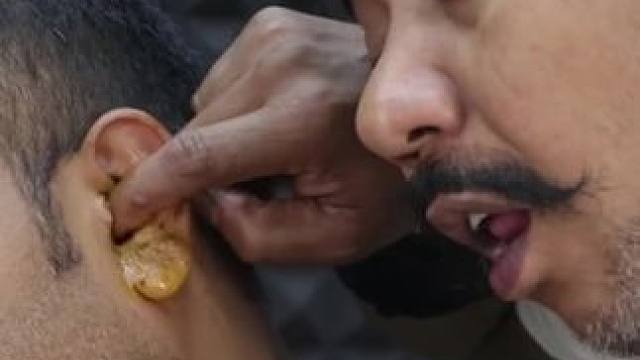 #可视掏耳勺 #不要再用棉签掏耳朵了 #挖耳勺