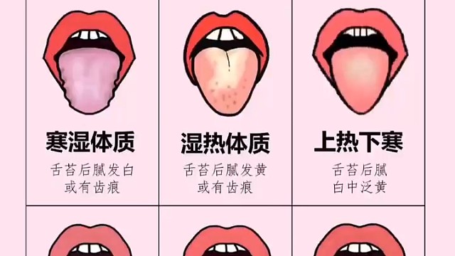 舌苔小知识