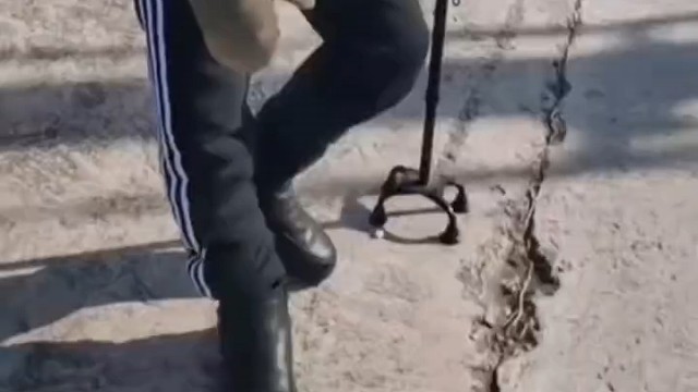 共济失调可改善