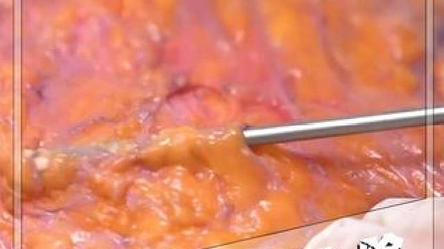 这坨东西谁见过、看完你就知道了！！ #脂肪 #科普 #涨知识 #燃脂的一百种方式