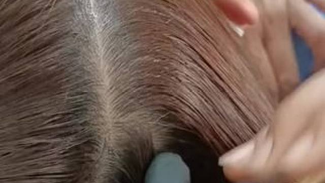 好用的拔毛夹子，一个就够！#眉夹 #拔毛神器