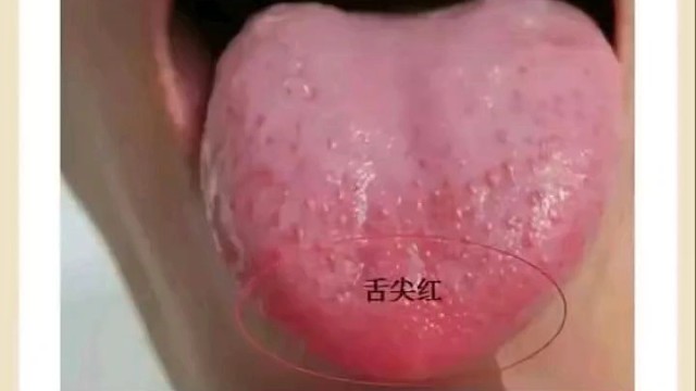 一起养生【第一百六十七起】