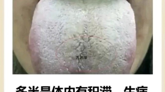 一起养生【第一百六十九期】