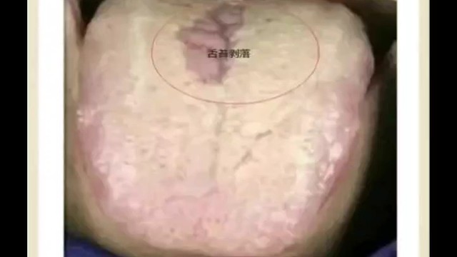 一起养生【第一百七十二期】