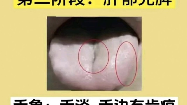 一起养生 【第一百七十四期】