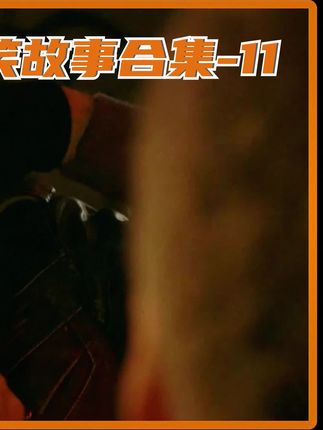 优秀的植发技术#反转 #搞笑 #意不意外 #喜剧 #拯救不开心 #植发