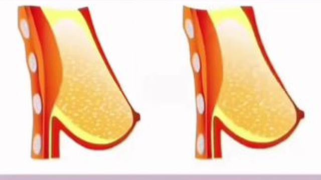 每天200个已成为习惯，开肩美背，肩颈松软了，哪哪都好了#开肩美背 #改善含胸驼背 #拉力器 #自律