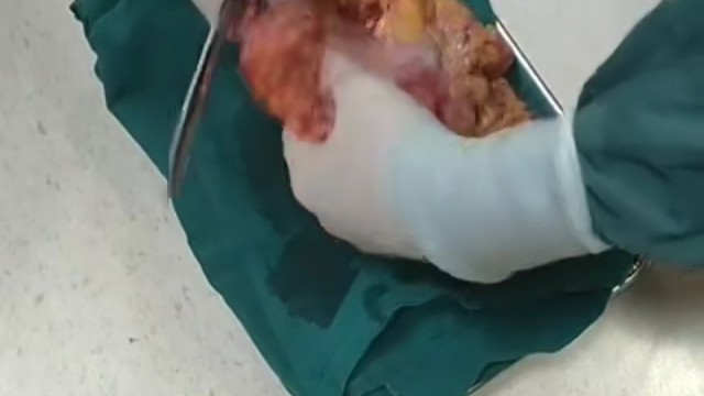 爸爸加油！我也加油相信会好起来！