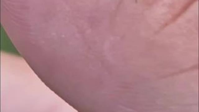 #蚊子吸血过程 #琐碎日常