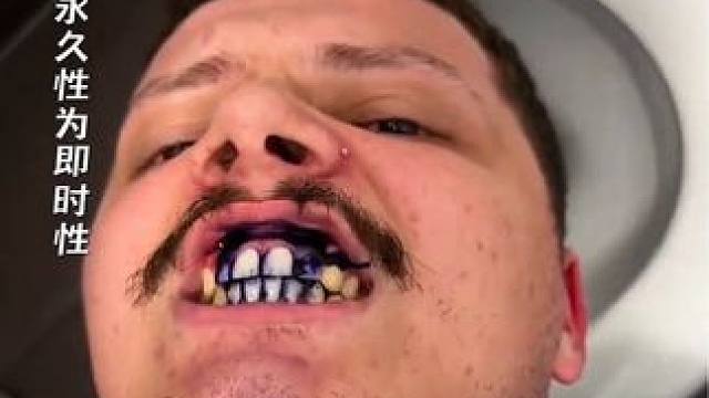 Hismile V34牙齿精华在橱窗里或置顶视频中#牙齿美白 #约会神器