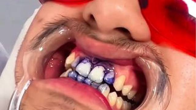 牙齿也有素颜霜了，产品的原理就是黄色和紫色中和变成白色，非永久性的哦  #牙齿美白 #hismile