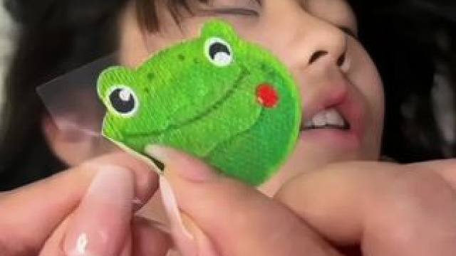 家长们一定要注意啦#张嘴呼吸会变丑 #闭嘴贴 #儿童闭口贴 #小孩张嘴睡觉的纠正方法 #闭嘴贴的正确