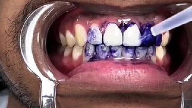 30秒拯救大黄牙！牙齿也有素颜霜了！调色原理逆袭大黄牙！非永久性的哦！#牙膏推荐 #牙齿美白 #牙黄