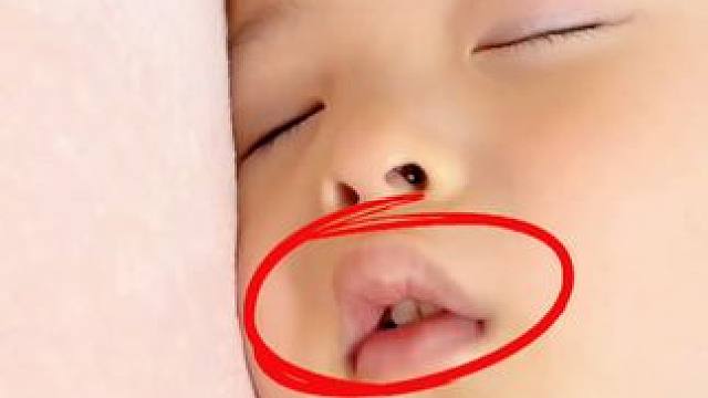 听说睡觉张嘴呼吸会变丑，宝妈们赶紧看看你家孩子是不是也总是张着嘴睡觉#闭嘴贴  #儿童闭口贴  #宝