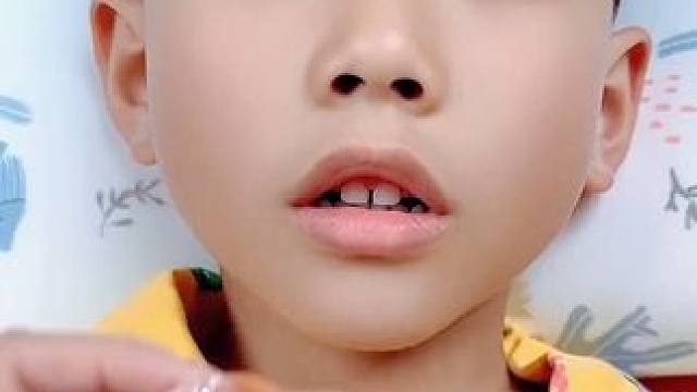 听说睡觉张嘴呼吸会变丑，宝妈们赶紧看看你家孩子是不是也总是张着嘴睡觉#闭嘴贴  #儿童闭口贴  #宝