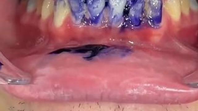 30秒拯救大黄牙！牙齿也有素颜霜了！调色原理逆袭大黄牙！非永久性的哦！#牙膏推荐 #牙齿美白 #牙黄